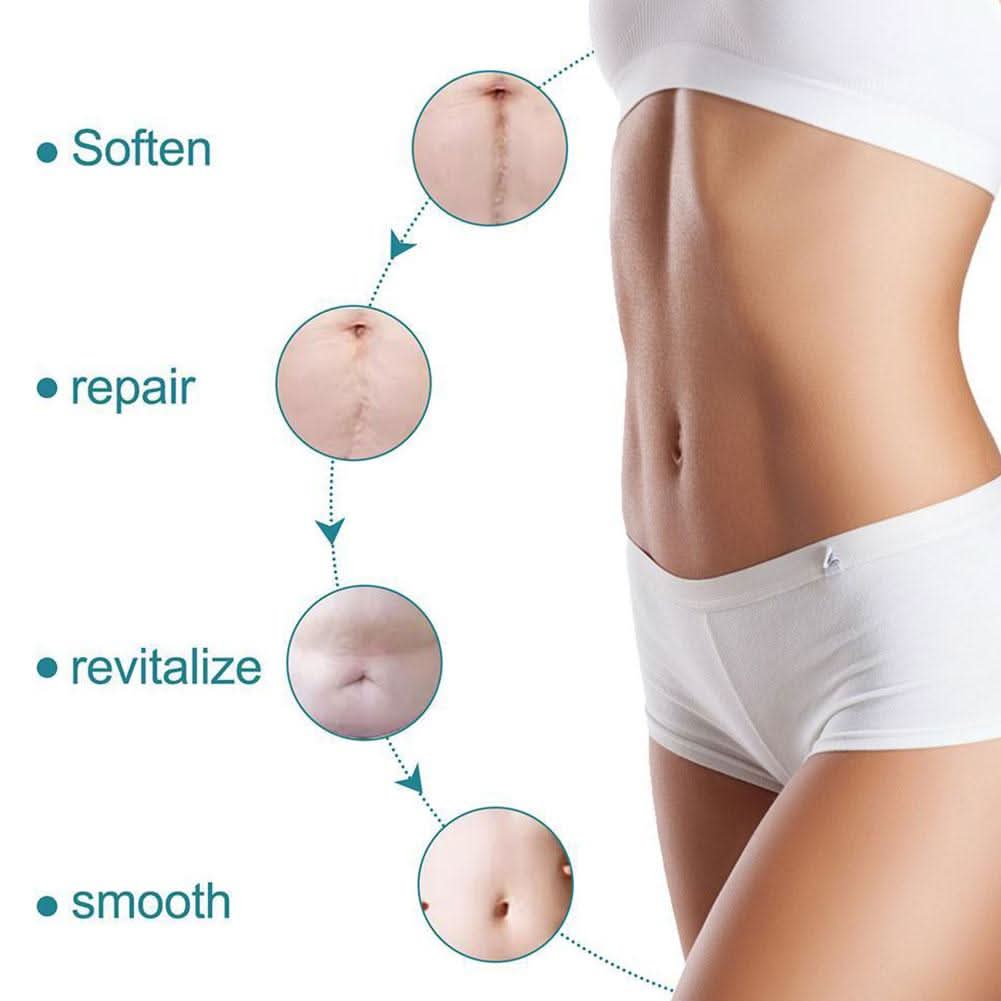 ScarErase™ – Advanced Scar Removal Tape (Reusable & Waterproof)